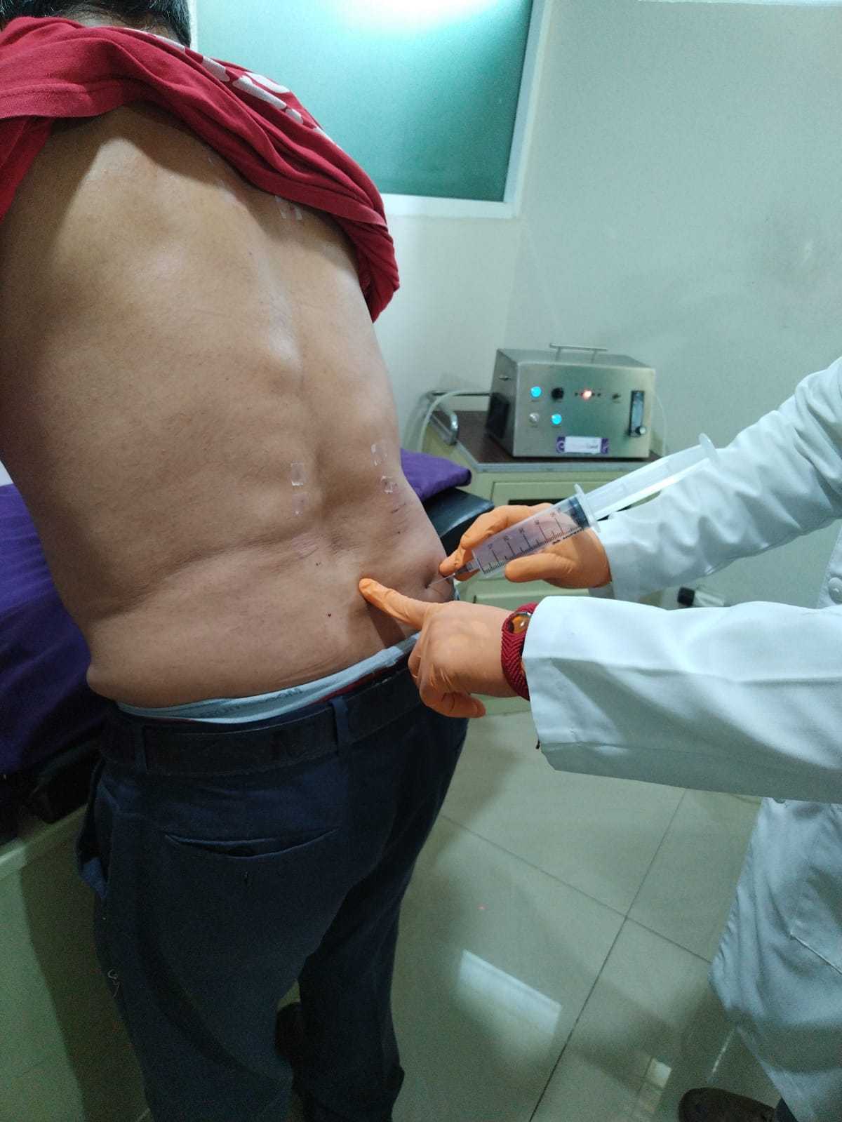 Caso de éxito hernia discal